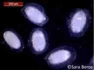 A. brevis