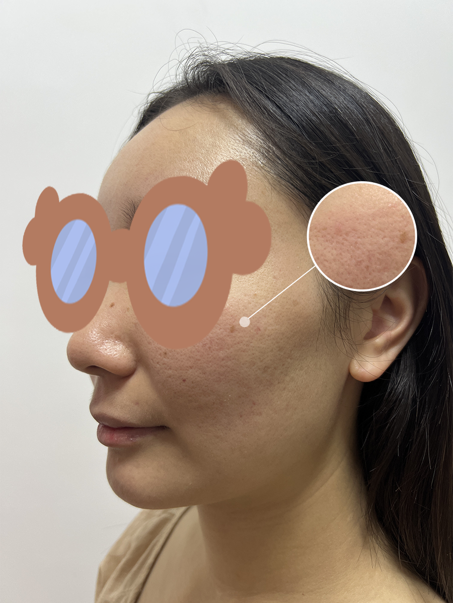 640-3885