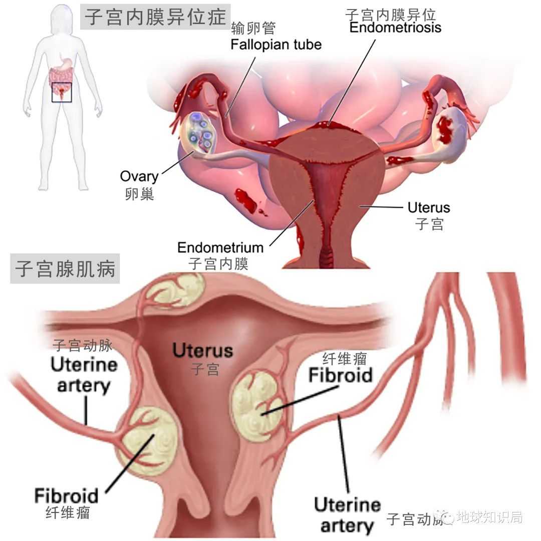 91122e6188c903a0d8693dcc96b47033ed6bbd8f (圖:woman2wome&endo-resolved)