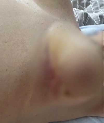 她胸部的疼痛也由此而來
