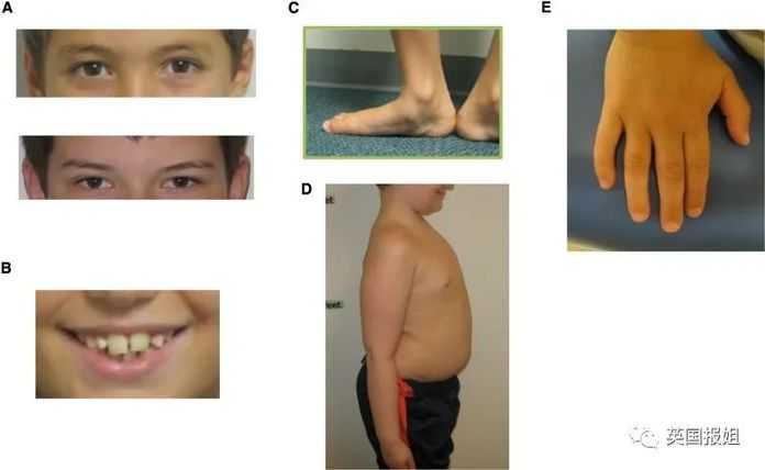 c91c3fa8b4ec9081d54f3fbc6e2d9731b7627a3f (圖源:ScienceDirect)