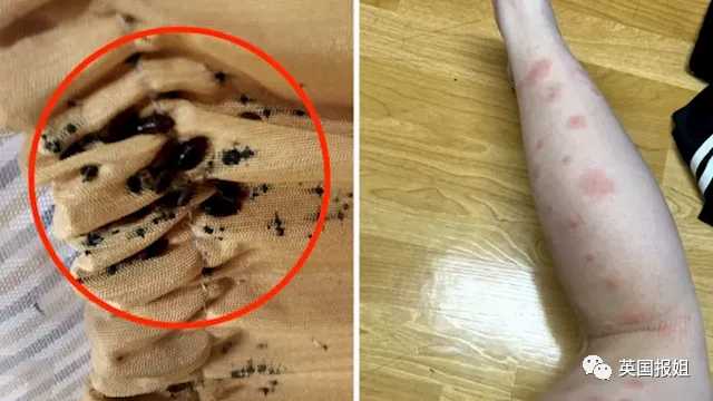 臭蟲的暴擊，終究還是來到了亞洲…