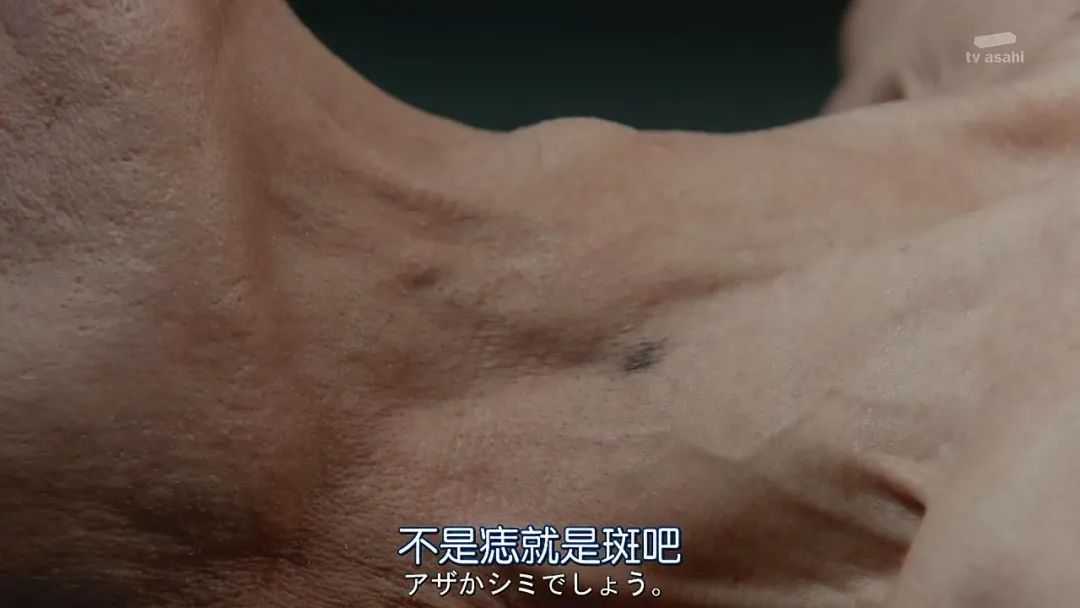 d11b69e68144097c41a44d449acd6d8f466af99d 而之後的研究,藤卷醫生發現了大問題