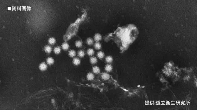 5596f04db3c09817b3e621821f0645aa4020dd28 #諾如病毒?