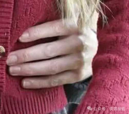98ca4d45a30ff3a55afe08c5413d144f7f7db99e 而她的右手看起來比其他地方都要模糊