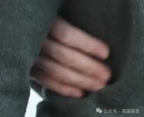 e7c50e95ec01d4b7db51f9a12d409a1e34af60d0 路易王子的手看起來很奇怪