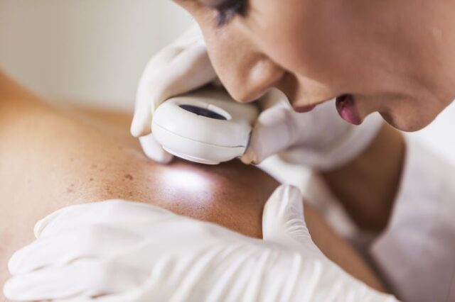 -1