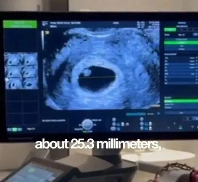 离大谱!英国男子用自己的卵子,让亲姐生下孩子 离大谱!英国男子用自己的卵子,让亲姐生下孩子